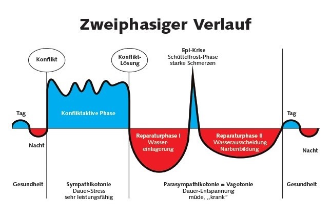 5BN - zweiphasiger Verlauf schematisch